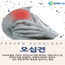 늘바른정형외과의원 네이버블로그