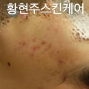 피디티 이미지