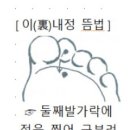 속이 불편해서 죽다살아나다 ㅡ이내정뜸 이미지