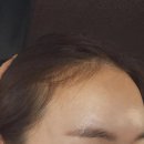 테오트리 - 안성시 | 문신 * 2차후기 * 반영구문신 * 테오트리 * 용산점...통증 * 후기 * 관리 * 재생크림 * 찐후기 * 리얼후기
