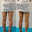 성북-돈암-2030 | 성신여대피부관리 하체랑 승모근 관리 받고 온 후기