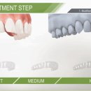 서울힐치과의원 이미지