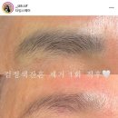 [영등포] 눈썹문신 후회한 사람 모여..! “유아브로우” 레이저 제거 리얼 후기