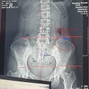 아레아필라테스 소사본점 | [소사 필라테스] 부천 소사역 기구필라테스 개인레슨 후기(PT후기)_아레아필라테스 소사본점
