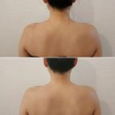 부산 화명동에스테틱 더샤인스캔앤바디케어 드레스라인 관리받은 후기