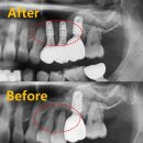 메디포레치과의원 이미지