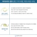 퍼스트안과의원 네이버블로그