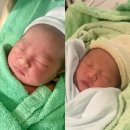 닥터피메디컬 | 캐나다 제왕절개 후기_ 산후 과다출혈 + 집에서 산후몸조리