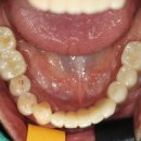 아이두치과기공소 이미지