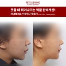 리터닝성형외과의원 이미지