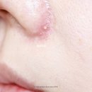 화산헬스케어 | 블랙헤드 제거 코옆 피지 없애는법 이니스프리 클렌징오일 꿀조합 추천 후기