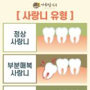 가우정치과의원 이미지