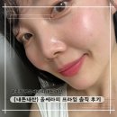 꾸미멍 | (내돈내산) 공장형 피부과에서 울쎄라피 프라임 300샷 솔직 후기