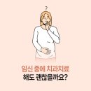 양산임신중 충치치료 가능할까요?