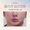 얼굴 실리프팅 볼살 턱살처짐, 팔자주름 리얼 후기 유투성형외과