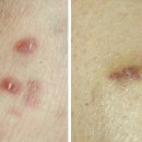 다산육종 이미지