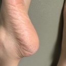 태흥메디칼 | 의정부패디플래닝 정말 잘하는 곳, 릴리안왁싱 추천