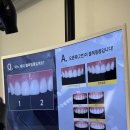 판치과기공소 이미지