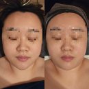 미인본가전주점 | [전주 피부샵] 미인본가 전주점/ 송천동 진정 피부관리/ 송천동 웨딩관리