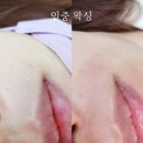 이곡동왁싱 대구 뷰티인와이 꼼꼼한 시술이 가능한 왁싱후기
