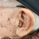 대동 독일보청기 이미지