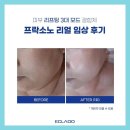 소노뷰티 이미지