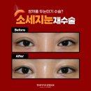 연세아이즈성형외과의원 이미지