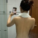 등드름 미강약침 한의원 다닌 전후와 현재상태 공유
