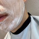 남성수지 | 남자턱수염 수지레이저제모 4회차 후기 공유