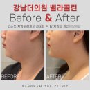 강남벨라의원 이미지