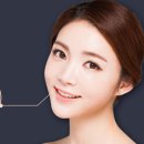 서울더가까이치과의원 네이버블로그