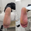 오거리약국 횡단보도 앞 | 부산레푸스 하단점 방문기 남편 무좀·부산발각질 케어 한 번에 해결!