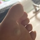 조마루로285번길 45 | [내돈내산] 미친 티눈과 작별인사 😵 (‼️징그러움 주의‼️)