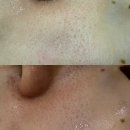 드웰 | 마산피부관리 잘하는 곳 / 댓거리 웨딩관리 추천 드웰에스테틱 솔직후기