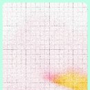 365효플란트치과 디지털 기공소 | 하단 치과 365효플란트치과, 임플란트 네비게이션 방식으로