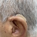 더365 보청기 이미지