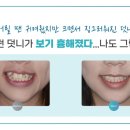 바른웅치과의원 이미지