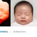 더블유여성병원 이미지