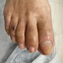 구로-고척-구로-811 | [온수/구로/신도림] 당뇨가 있다면 더욱더 필수적인 관리 당뇨발 관리 지금 해야 합니다