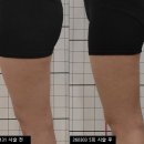 한지영한의원 | 허벅지 아크로컷, 몇 회부터 달라질까?