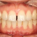 부산예스치과의원 네이버블로그