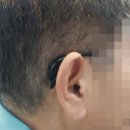 굿모닝병원 앞 | 천안보청기센터 굿모닝보청기 순천향병원센터 후기