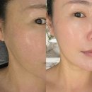 스킨메디언스 | 충주피부관리 잘하는 곳, 뷰티메디언스432에서 피부와 두피 토탈 케어받고 왔어요