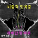 잇츠비의원 이미지