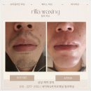 아이스왁싱