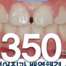 다치과기공소 네이버블로그