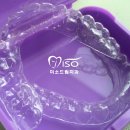 클리어치과기공소 이미지