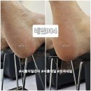 시흥각질관리 잘하는 곳 네일904 NAIL904