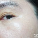 올바르다케어