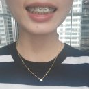 명진금속 | 교정 진료 1